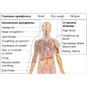 Disinfection Pittsburg  Services